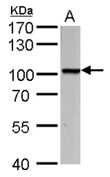 Anti-PROX1 antibody used in Western Blot (WB). GTX129143